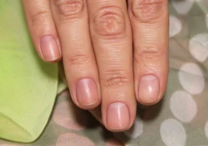 Травмирование ногтевой пластины и кожи при аппаратном маникюре исключено
