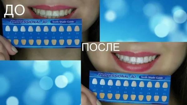 Отбеливающие полоски для зубов: 3d white, Blend a Med, Crest, Rigel, Advanced teeth, Oral Pro, Bright light. Цены в аптеках
